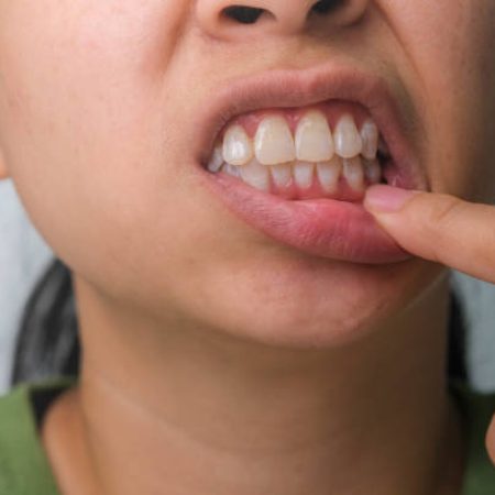 Asian woman holding her hand on her cheek feeling toothache, tooth decay, gingivitis or bad breath problem. Toothache and oral health concept.